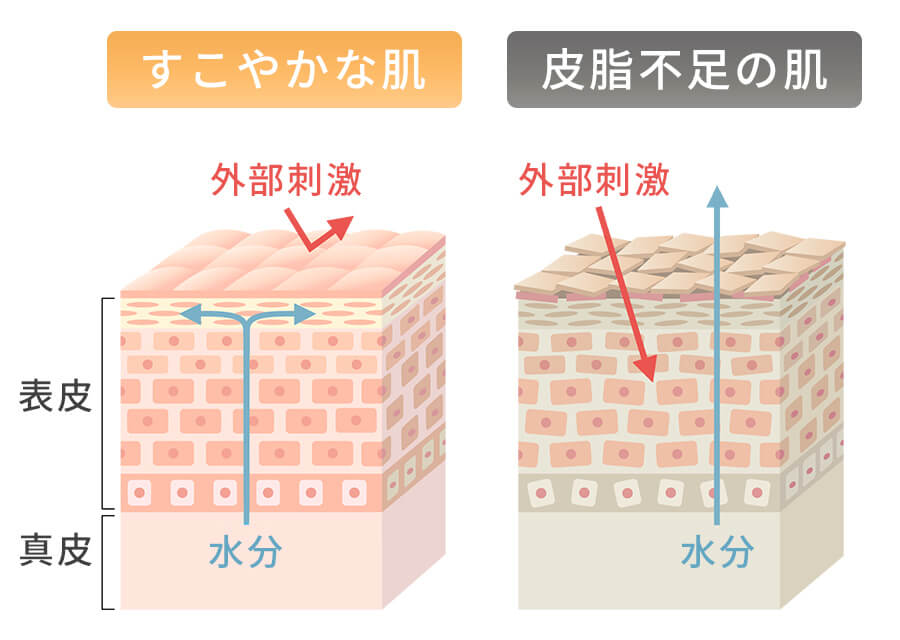 皮脂不足を補い、肌トラブルを防ぐ