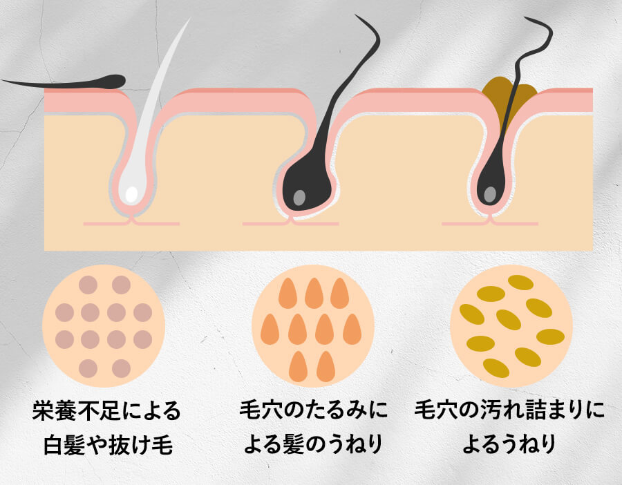 悩める髪と頭皮にWのアプローチ